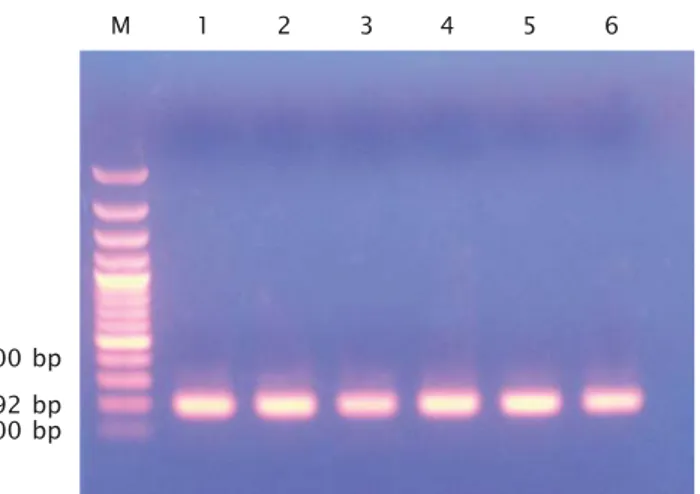 Gambar 1. Profil produk Polymerase Chain Reaction (PCR) DNA bakteri Streptococ- Streptococ-cus agalactiae (192 bp)