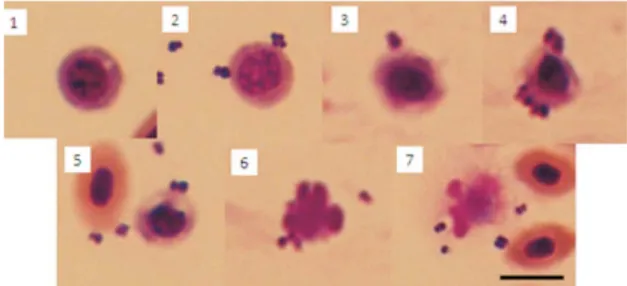 Gambar 1 Proses fagositosis dan penghancuran partikel bakteri pada ikan nila  yang divaksinasi Streptococcus agalactiae tipe â-hemolitik, 1 bar = 20µm