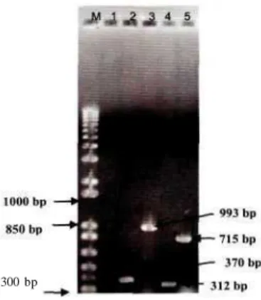Gambar 2. Struktur 3-D protein hasil translasi DNA melalui proses PCR (a) dan DNA yang ada di GenBank (b)