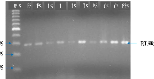Gambar  1.  Hasil  Amplifikasi  Gen  MHC  DRB3exon  2  yang  divisualisasi  pada  Gel  Agarose  1,5%.M  :  Marker  (100  bp)  ;  1-10  :  sampel  Sapi  Perah  FH  dari  Kabupaten Enrekang ; bp : base pair 
