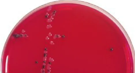 Gambar 1. Cronobacter (Enterobacter) sakazakii yang umbuh di atas medium spesifik buatan  bioMérieux (Rapid Microbiology, 2008a).