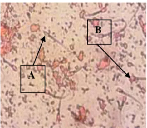 Gambar 1. Viabilitas spermatozoa A: spermatozoa hidup, B: Spermatozoa Mati  (Perbesaran 10x40) 