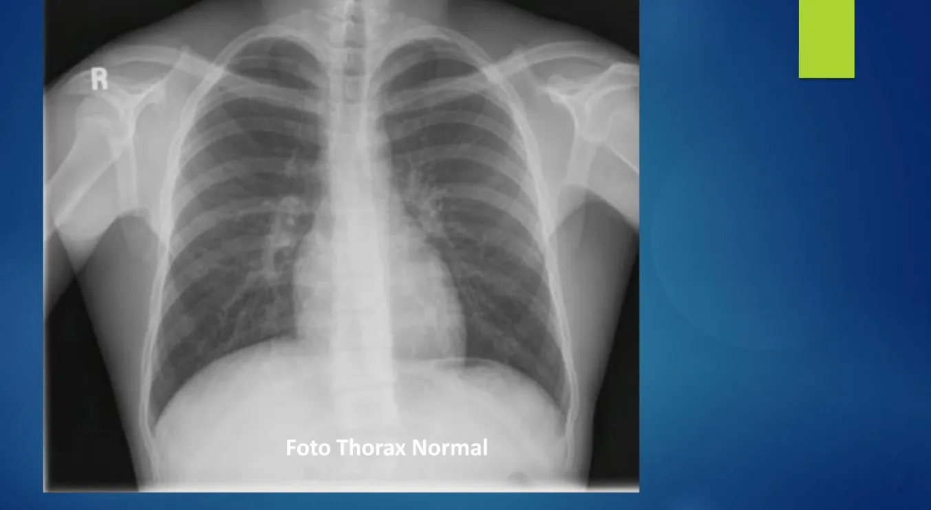 Foto Thorax Normal
