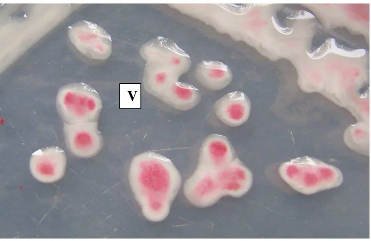Gambar  2.     Sel     bakteri  R. solanacearum                       (0.5 - 1.0) x (1.5 - 4.0)   berbentuk batang  dengan ukuran μm 