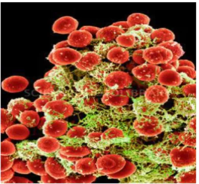 Gambar 4.  Staphylococcus epidermidis (Anonim, 2000) 