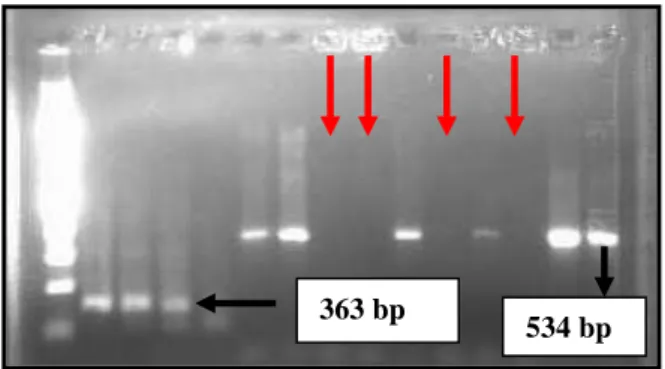 Gambar 2. Hasil nested PCR 