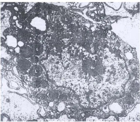 Gambar 1. Struktur mikrograf elektron sebuah makrofag, huruf L  adalah lisosom Sekunder yang bersisi materi yang di fagositose 
