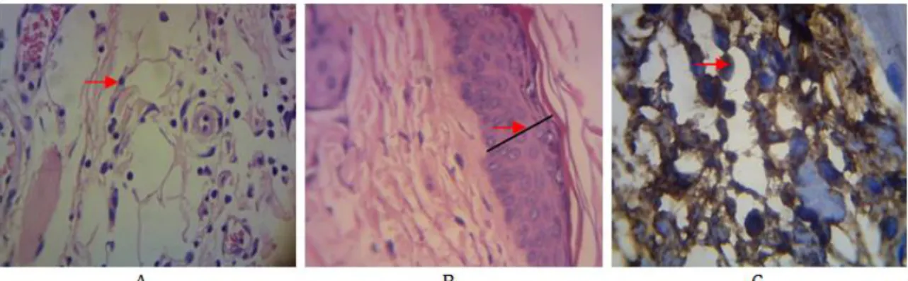 Gambar  1.  Gambaran  mikroskopis  jaringan  kulit  dengan  pengecatan  hematoksilin  eosin  (HE)  (A)  sel  radang,    (B)    ketebalan  epidermis  dan  (C)    sel  yang  mengekspresikan  COX-2  dengan  pengecatan  imunohistokimia  