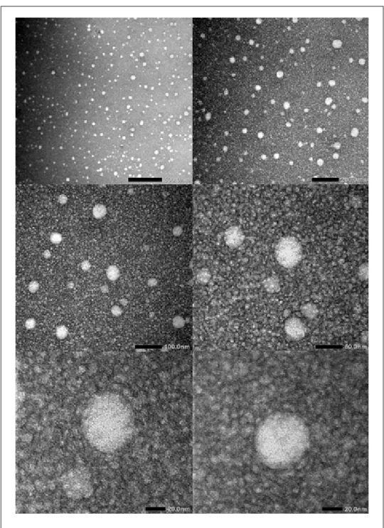 Gambar 3.  Morfologi globul nanoemulsi astaxanthin (perbesaran 20 nm hingga 500 nm).