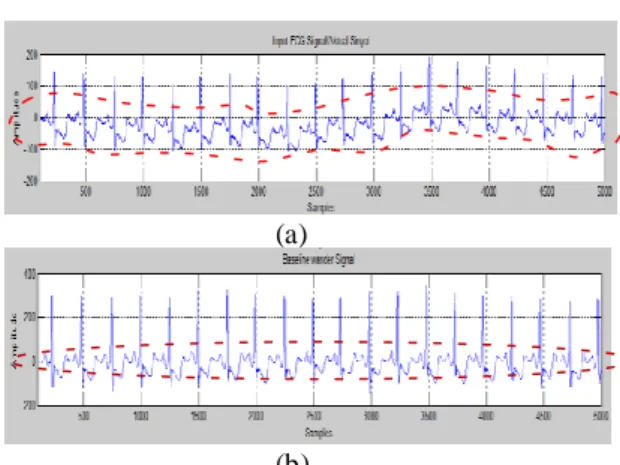 Tabel  1.  Hasil  Deteksi  Puncak  R  pada  Data  MIT- MIT-BIH  Arrhytmia 