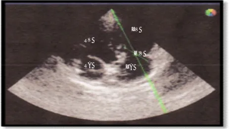 Gambar  14.    Cara  pengambilan  di  katup  mitralis  (Left  Apical  Scanning  Views)  PWD  echocardiography  normal  anjing  kampung  (Canis  lupus  familiaris)