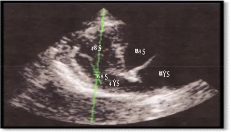 Gambar 15.  Cara pengambilan di katup trikuspidalis left apical scanning views  PWD echocardiography normal anjing kampung (Canis lupus  familiaris)