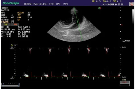 Gambar 16. Hasil  scan perhitungan aliran darah  melalui  katup mitralis  dengan PWD echocardiography anjing kampung normal