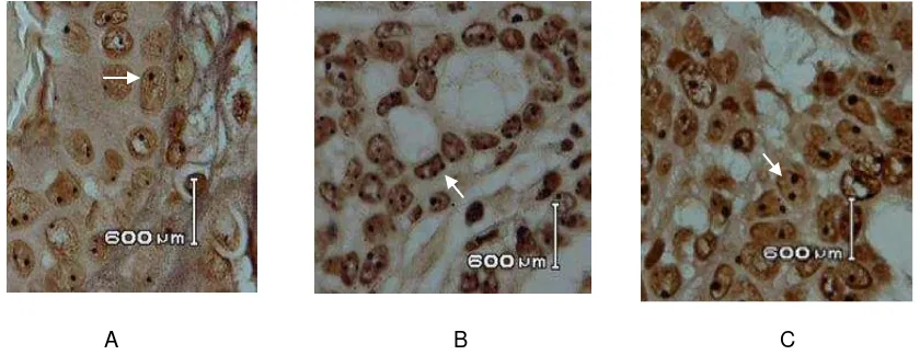Gambar 1–Efek pemberian ekstrak terhadap jumlah black dot hasil pengecatan AgNOR. Pengecatan AgNOR dilakukan seperti pada metodologi terhadap preparat dibuat dari jaringan tumor kelenjar payudara tikus pada minggu ke-16 setelah pemberian DMBA terakhir