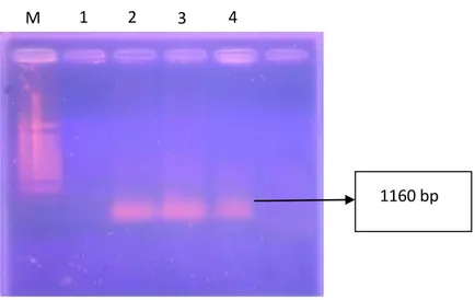 Gambar 4.  Hasil elektroforesis pada gel agarose 1% dari DNA teramplifikasi : M 