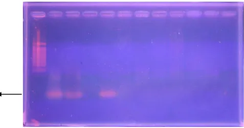 Gambar 7. Hasil Amplifikasi DNA Bakteri L. asiaticum dari tanaman jeruk 1 bergejala  Parsial dengan Teknik PCR Menggunakan Primer 16S rDNA pada Gel Agarose 1%