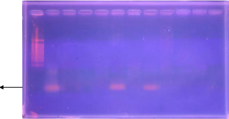 Gambar 8. Hasil PCR DNA Bakteri L. asiaticum dari sampel tanaman 2 bergejala Parsial  menggunakan Primer 16S rDNA pada Gel Agarose 1%
