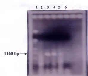 Gambar 1. Hasil Amplifikasi DNA Bakteri L. asiaticum	dari	 Serangga	Vektor	D. citri	dengan	Teknik	PCR	Menggunakan	Primer	