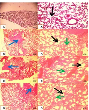 Tabel 2. Data deskriptif pengamatan histopatologi  Pelebaran  Lumen  Alveolus Penebalan Dinding Alveolus Infiltrasi Limfosit Kn 1 1 1 E 0 1 1 1 E 1 2 2 2 Kv 2 2 2