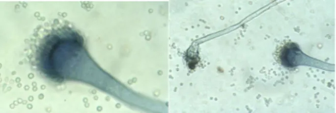 Gambar 1. Pengamatan dengan mikroskop konidia jamur  Aspergillus fumigatus.