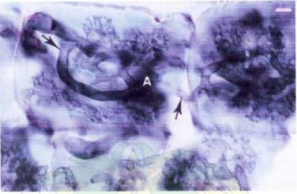 Gambar 1. Struktur Mikoriza dalam Sel Akar, Hifa Terlihat Jelas di dalamnya  (Native Plant Production, 2006) 
