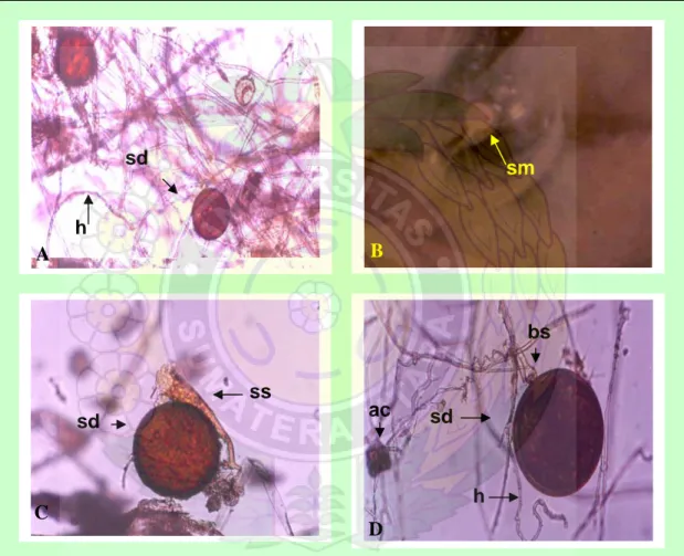 Gambar 9.   Spora-spora yang berkembang dalam kultur spora tunggal dengan  teknik PDOC dari jenis Glomus (A), Acaulospora (B dan C) dan  Gigaspora (D): sd = spora dewasa, h = hifa, sm = spora muda, ss =  sporiferous saccule, bs = bulbous suspensor, ac = au