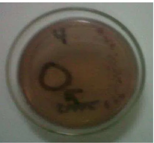 Gambar 4.6 Salah satu sampel (no.4) ditanam  pada media selektif SMAC yang diinkubasi pada suhu 35-37° C selama 24 jam  dan timbul koloni yang bening, tidak berwarna (colourless) dimana koloni tersebut diidentifikasi sebagai E.coli O157(dalam lingkaran dan