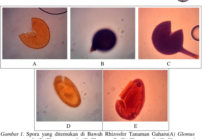 Gambar 1.  Spora  yang  ditemukan  di  Bawah  Rhizosfer  Tanaman  Gaharu(A)  Glomus  sp1, (B) Gigaspora sp1, (C) Glomus sp2, (D) Glomus sp3, (C) Glomus sp 4  perbesaran 40x