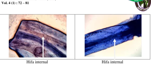 Gambar 3.   Bentuk infeksi FMA pada akar  Gaharu perbesaran 40x dan 10x (FMA  form of Infection at the Root of Aguilaria spp Magnification 40x and 10x)  Berdasarkan  hasil  penelitian  pada 