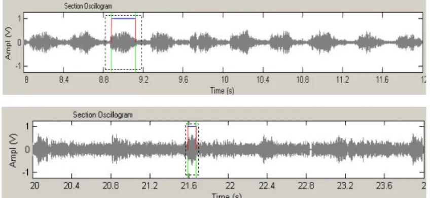 Gambar 2  Oscilogram suara A yang dimiliki oleh D. mannifera (kiri) dan         bentuk imagonya (kanan)