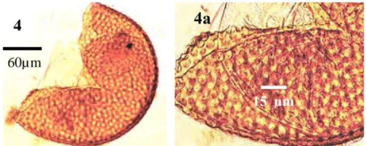 Gambar 4 Spora Acaulospora foveata, 4a perbesaran perhiasan  