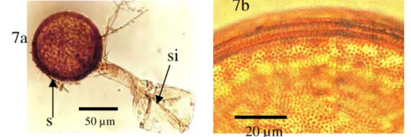 Gambar 7 Acaulospora tuberculata, 7a spora (s) dengan sel induk spora(si),   7b Perbesaran dinding spora dan perhiasan spora 