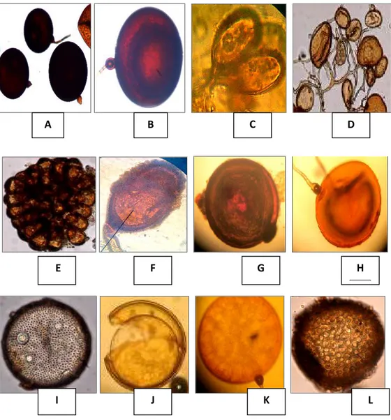 Gambar 5.1: Foto spora endomikoriza yang teridentifikasi dibawah mikroskop Binokuler  (perbesaran  400X)  (A.Glomus  etunicatum; B.Glomus moseae.;C.Glomus.aggregatum; D.Glomus  intraradices; E