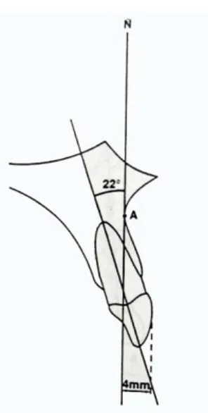 Gambar 11. Skema pengukuran inklinasi gigi insisivus rahang atas dan rahang bawah  (Jacobson, 1995) 