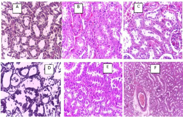 Gambar  5.7. Gambaran Sediaan Histopatologis Ginjal Berdasarkan 3 Parameter    A. Skor  Degenerasi Bengkak Keruh 1, Nekrosis inti 1 dan Hyaline Cast = 0, 