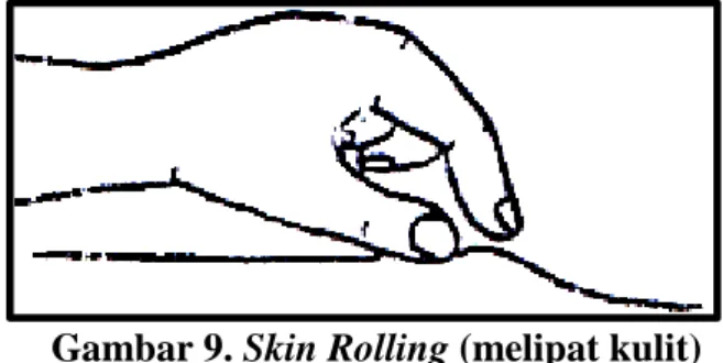 Gambar 9. Skin Rolling (melipat kulit)  f.  Pengaruh massage terhadap penderita gejala insomnia  