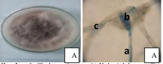 Gambar 6. Cladosporium sp. A) Koloni dalam media PDA. B) Mikroskopik (a) cabang apikal dari konidiofor (b) Ramokonidia (c) hifa.Perbesaran