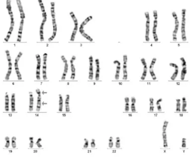 Gambar 1. Translokasi kromosom 21. 17