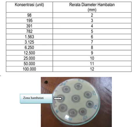 Tabel  2  Hasil  uji  antimikroba  Berbagai  Konsentrasi  Nistatin  Terhadap  Pertumbuhan  C.albicans  Metode  Kirby Bauer 