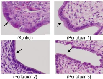 Gambar histopatologi kelompok K, P1, P2 dan P3, Tanda panah menunjukkan sel epitel mukosa  tuba fallopii (Hematoxylin-Eosin, 400x) 