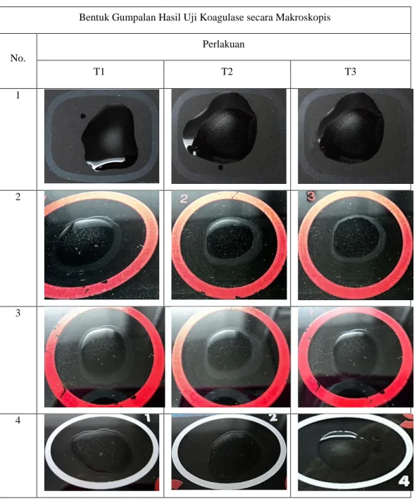 Tabel 2.     Perbedaan Bentuk Gumpalan Hasil Uji Koagulase secara Makroskopis  Bentuk Gumpalan Hasil Uji Koagulase secara Makroskopis 