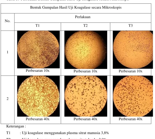 Tabel 3.  Perbedaan Bentuk Gumpalan Hasil Uji Koagulase secara Mikroskopis   Bentuk Gumpalan Hasil Uji Koagulase secara Mikroskopis 