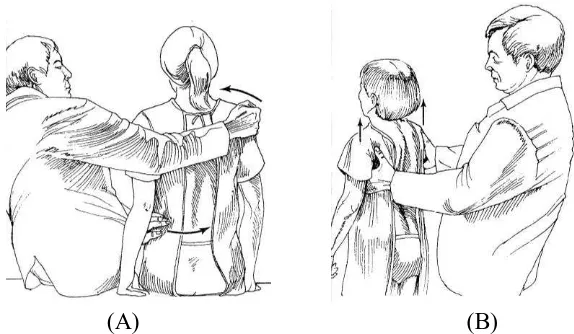 Gambar 23. (A) menilai spinal flexibility dengan tiga point bending untuk menilai korektibilitas dari curvature scoliosis