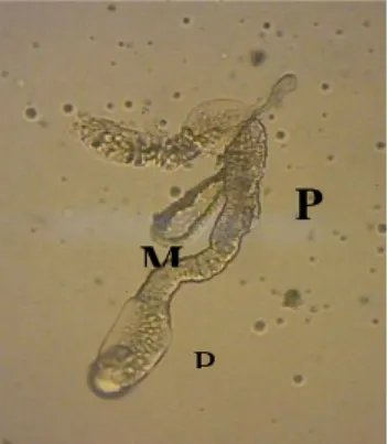 Gambar .1 Kelenjar saliva An.sundaicus betina (A) dan An.sundaicus jantan (B)        Keterangan : M: lobus medial; PL: lobus lateral proksimal; DL: lobus                                lateral distal 
