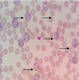 Gambar  2.  Grafik  perkembangan  derajat  parasitemia  (%)  populasi  mencit percobaan   