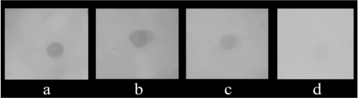 Gambar 4.2   Hasil visualisasi Dot Blot, membran PVDF diinkubasi dengan plasma darah 