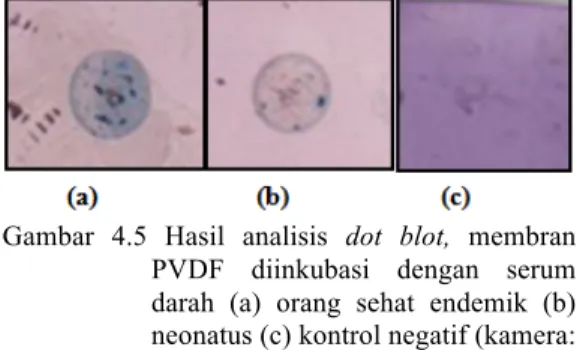 Gambar  4.5  Hasil  analisis  dot  blot,  membran  PVDF  diinkubasi  dengan  serum  darah  (a)  orang  sehat  endemik  (b)  neonatus (c) kontrol negatif (kamera: 