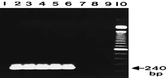 Gambar 3 Produk amplifikasi nested-2 Plasmodium sp dari sampel darah (Singh et al.