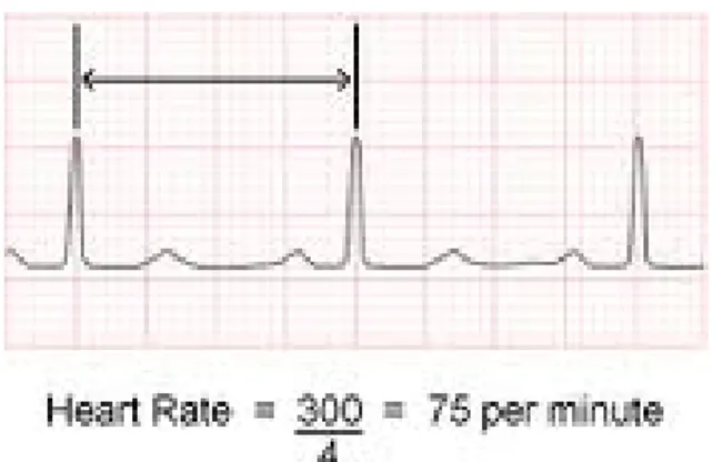 Gambar 2.4. Cara Menghitung Frekuensi Jantung dengan Metode 300   dibagi dengan Jumlah Kotak Besar dari R-R 