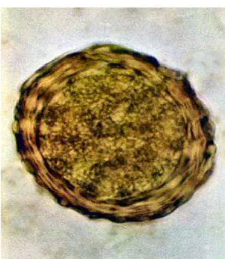 Gambar 1 . telur Ascaris Suum  (Sumber : Dewi,2007) 